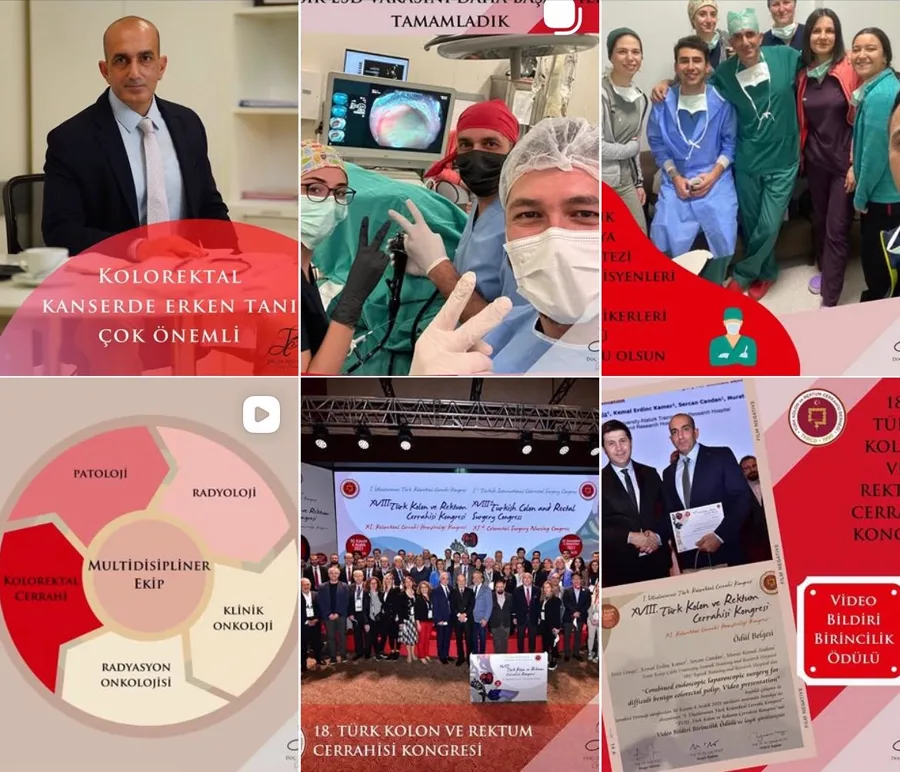 Doç. Dr. Fevzi Cengiz Instagram hesabından altı paylaşım: kolorektal kanserde erken tanı, ameliyathane ekibi, multidisipliner ekip ve kongre ödülü
